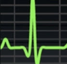HeartSimulator